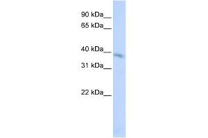 WB Suggested Anti-TMEM82 Antibody Titration:  0. (TMEM82 抗体  (N-Term))