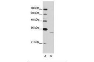 Image no. 1 for anti-Exosome Component 6 (EXOSC6) (N-Term) antibody (ABIN6736212) (EXOSC6 抗体  (N-Term))