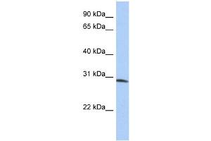 WB Suggested Anti-ZFYVE28 Antibody Titration:  0.
