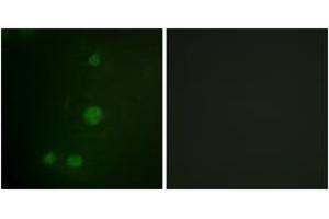 Immunofluorescence analysis of HuvEc cells, using Retinoblastoma (Ab-811) Antibody.