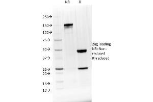 SDS-PAGE Analysis Purified BTLA Mouse Monoclonal Antibody (BTLA/1528). (BTLA 抗体)