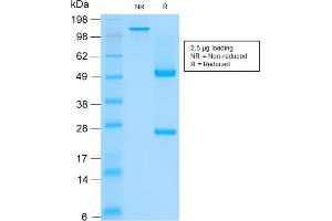 SDS-PAGE Analysis of Purified CK HMW Mouse Recombinant Monoclonal Antibody (rKRTH/2148). (Recombinant Cytokeratin 2 抗体)