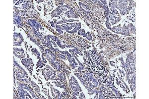 IHC analysis of COL4A2 using anti-COL4A2 antibody (ABIN7600234).