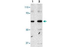Western blot analysis of PAK4 in SW480 cell lysate with PAK4 polyclonal antibody  at 1 and 2 ug/mL . (PAK4 抗体  (Internal Region))