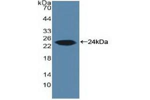 Detection of Recombinant ARO, Human using Polyclonal Antibody to Aromatase (ARO) (Aromatase 抗体  (AA 196-373))