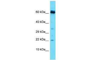 Host: Rabbit Target Name: CCDC115 Sample Type: Jurkat Whole Cell lysates Antibody Dilution: 1. (CCDC115 抗体  (N-Term))