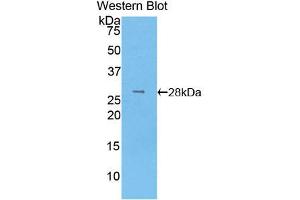 Western blot analysis of the recombinant protein. (LOXL3 抗体  (AA 519-726))
