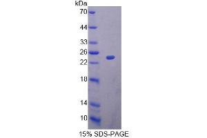 SDS-PAGE analysis of Rat MRPL1 Protein. (MRPL1 蛋白)