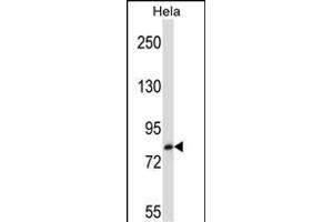 TRIM37 Antibody (C-term) (ABIN657211 and ABIN2846321) western blot analysis in Hela cell line lysates (35 μg/lane). (TRIM37 抗体  (C-Term))