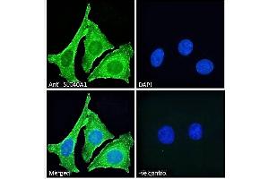 Immunofluorescence (IF) image for anti-Solute Carrier Family 40 (Iron-Regulated Transporter), Member 1 (SLC40A1) (AA 245-259) antibody (ABIN2613478)