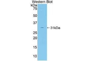 Western blot analysis of the recombinant protein. (CNTF Receptor alpha 抗体  (AA 120-358))