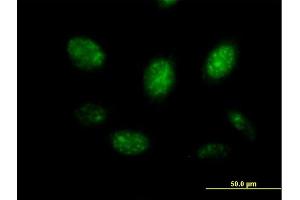 Immunofluorescence of purified MaxPab antibody to MYB on HeLa cell. (MYB 抗体  (AA 1-640))