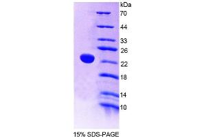 SDS-PAGE analysis of Human PTPRE Protein.