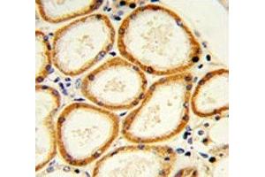 IHC analysis of FFPE human lung with Caspase-2 antibody (Caspase 2 抗体  (AA 198-226))