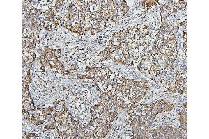 IHC analysis of HSPD1 using anti-HSPD1 antibody (ABIN7600976). (HSPD1 抗体  (AA 260-496))