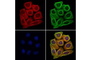 ABIN6260014 and ABIN6279139 staining Hela cells by IF/ICC.