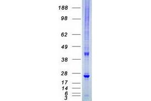 Western Blotting (WB) image for Heat Shock 22kDa Protein 8 (HSPB8) protein (Myc-DYKDDDDK Tag) (ABIN2723117)