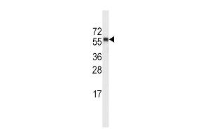 Western Blotting (WB) image for anti-Cytochrome P450, Family 4, Subfamily A, Polypeptide 11 (CYP4A11) (AA 407-435), (C-Term) antibody (ABIN5534044)