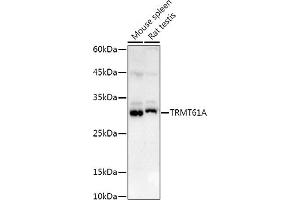 Western blot analysis of extracts of various cell lines, using TRMT61A antibody (ABIN6132806, ABIN6149558, ABIN6149559 and ABIN6214904) at 1:1000 dilution. (TRMT61A 抗体  (AA 1-289))
