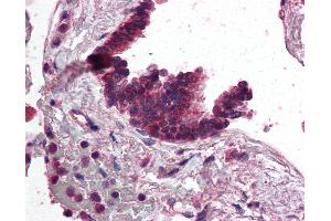 Immunohistochemistry (IHC) image for anti-Adaptor-Related Protein Complex 3, delta 1 Subunit (AP3D1) (AA 686-698) antibody (ABIN296663)