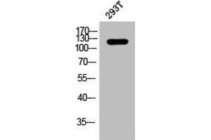Western Blot analysis of 293T cells using Phospho-p120 (Y228) Polyclonal Antibody (CTNND1 抗体  (pTyr228))
