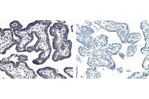 Immunohistochemistry (IHC) image for anti-Receptor Tyrosine-Protein Kinase ErbB-3 (ERBB3) antibody (ABIN967437) (ERBB3 抗体)