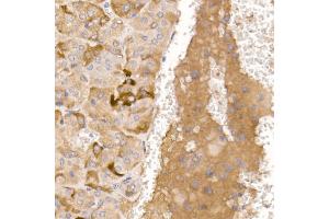 Immunohistochemistry of paraffin-embedded mouse adrenal gland using AGRP Rabbit pAb (ABIN7265515) at dilution of 1:50 (40x lens). (AGRP 抗体  (AA 21-132))