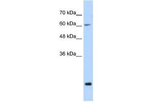 WB Suggested Anti-FUS Antibody Titration:  0. (FUS 抗体  (N-Term))