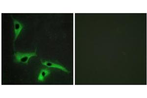 Immunofluorescence analysis of HeLa cells, using TSPAN8 antibody. (Tspan-8 抗体  (Internal Region))