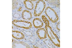 Immunohistochemistry of paraffin-embedded human kidney using OLR1 Antibody. (OLR1 抗体)