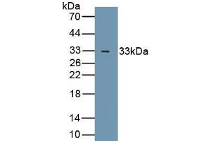 Detection of Recombinant GSK3b, Human using Polyclonal Antibody to Glycogen Synthase Kinase 3 Beta (GSK3b) (GSK3 beta 抗体  (AA 122-375))