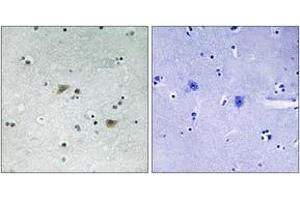 Immunohistochemistry (IHC) image for anti-Proto-oncogene tyrosine-protein kinase Src (Src) (AA 41-90), (pSer75) antibody (ABIN1532080)