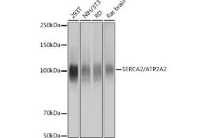 Western blot analysis of extracts of various cell lines, using SERC/ Rabbit mAb (ABIN7265753) at 1:1000 dilution. (ATP2A2 抗体)