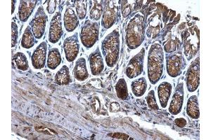 IHC-P Image CD2AP antibody detects CD2AP protein at cytosol on mouse colon by immunohistochemical analysis.