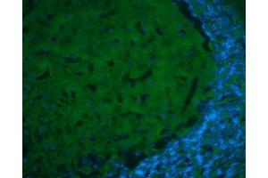 Immunohistochemistry (IHC) image for anti-Glutamate Decarboxylase 1 (Brain, 67kDa) (GAD1) (N-Term) antibody (ABIN2855214)