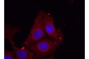 Immunofluorescence staining of methanol-fixed HeLa cells using GAP43 (Phospho-Ser41) Antibody (E011281, Red) (GAP43 抗体  (pSer41))