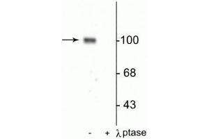 Western blot of rat hippocampal lysate showing specific immunolabeling of the ~100 kDa GluR1 protein phosphorylated at Ser845 in the first lane (-). (Glutamate Receptor 1 抗体  (pSer845))