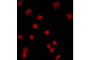 ABIN6274685 staining COLO205 by IF/ICC. (TCEB3C 抗体  (Internal Region))