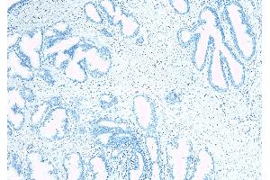 ABIN334520 Negative Control showing staining of paraffin embedded Human Prostate, with no primary antibody. (TUSC3 抗体  (Internal Region))