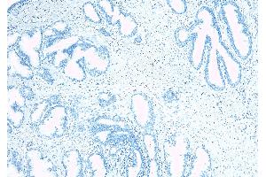 ABIN334520 Negative Control showing staining of paraffin embedded Human Prostate, with no primary antibody. (TUSC3 抗体  (Internal Region))