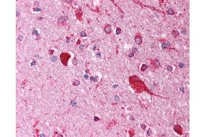 Anti-FOXI1 antibody IHC of human brain, cortex. (FOXI1 抗体  (AA 221-270))