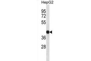 Western Blotting (WB) image for anti-Epidermal Retinal Dehydrogenase 2 (RDHE2) antibody (ABIN2998329) (SDR16C5 抗体)