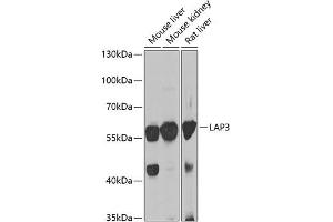 Western blot analysis of extracts of various cell lines, using L antibody (ABIN6131434, ABIN6143087, ABIN6143088 and ABIN6222907) at 1:1000 dilution. (LAP3 抗体  (AA 260-519))