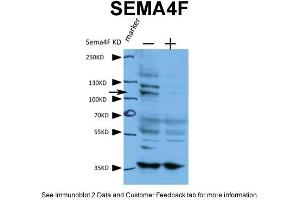 human cell line A431 Primary antibody dilution and incubation time:1:600, 4 degree overnightSecondary antibody used and dilution and incubation time: 1:3000, RT 2 hours (SEMA4F 抗体  (N-Term))