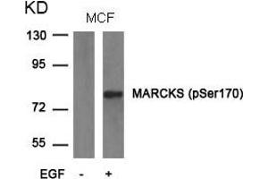 Western blot analysis of extracts from MCF cells untreated or treated with EGF using MARCKS(phospho-Ser170) Antibody. (MARCKS 抗体  (pSer170))