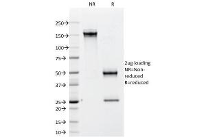 SDS-PAGE Analysis Purified CD79b Mouse Monoclonal Antibody (IGB/1842).