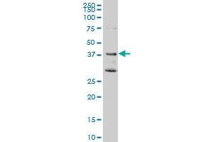 DNAJB2 monoclonal antibody (M02), clone 1B7. (DNAJB2 抗体  (AA 216-324))