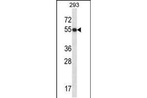 Western Blotting (WB) image for anti-General Transcription Factor IIE, Polypeptide 1, alpha 56kDa (GTF2E1) (AA 93-121), (N-Term) antibody (ABIN5536203)