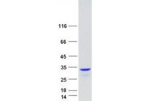 Validation with Western Blot