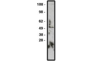 Western blot using GLI1 antibody , used  at 1:200k dilution. (GLI1 抗体)